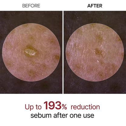 Dr.Melaxin Peel Shot Glow Rice Ampoule